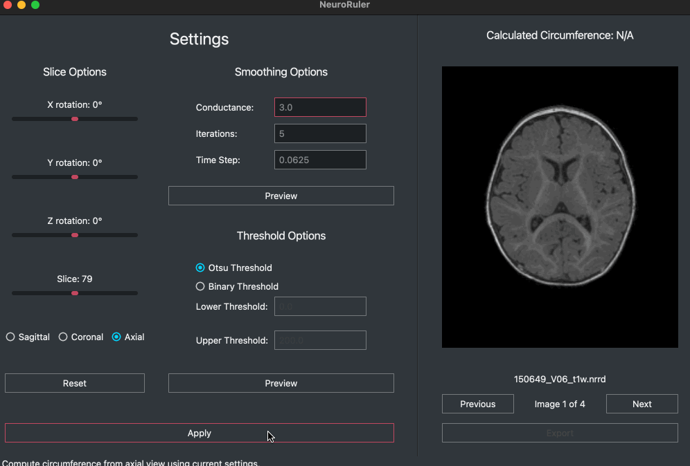 NeuroRuler demo